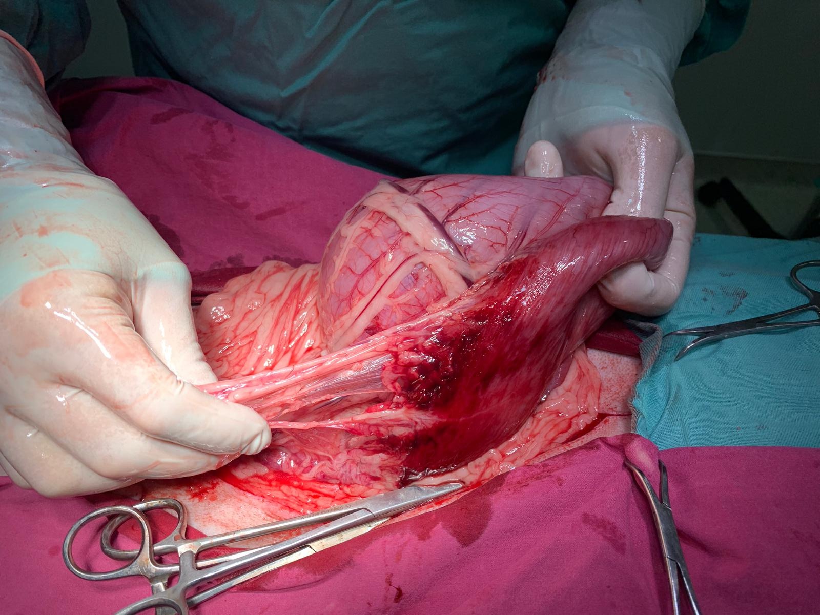 Chirurgie de urgență